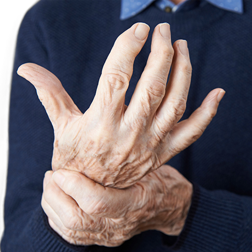 L’arthrose : une maladie métabolique ?